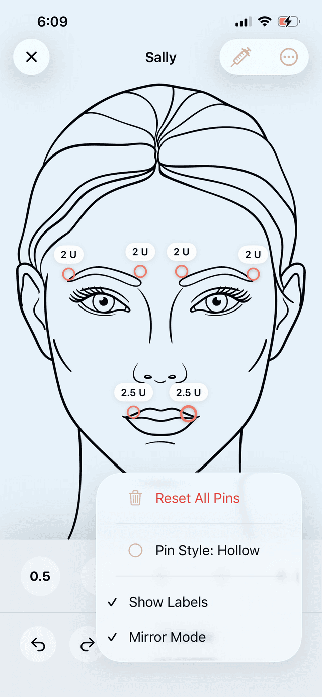 Facial mapping in Aesthetic Injector Planner