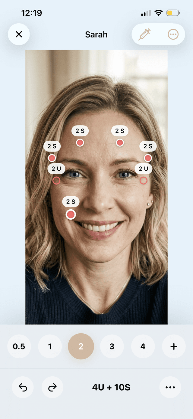 Mirrored pin placement across the facial midline